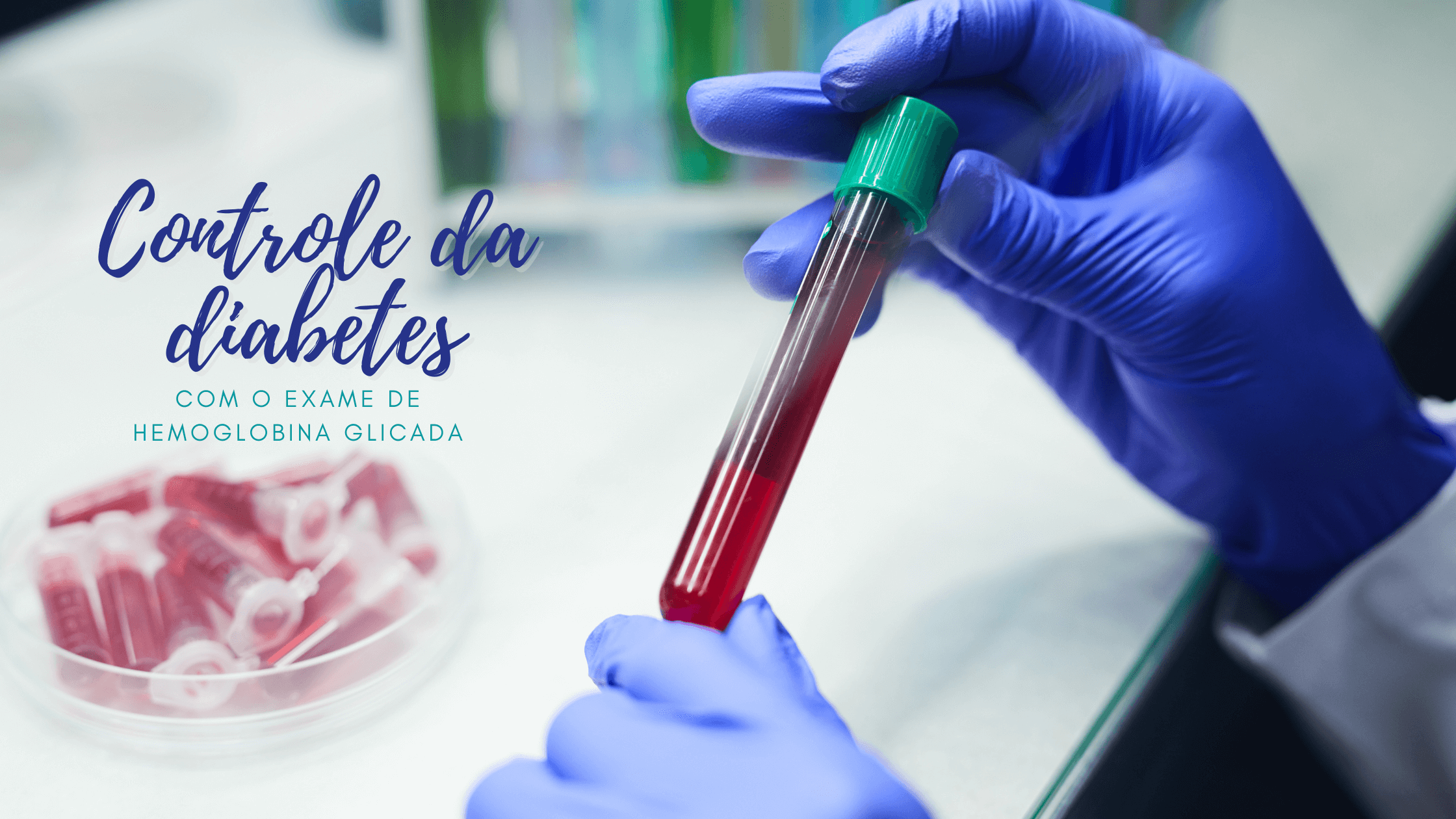 Exame de Hemoglobina Glicada no Controle da Diabetes