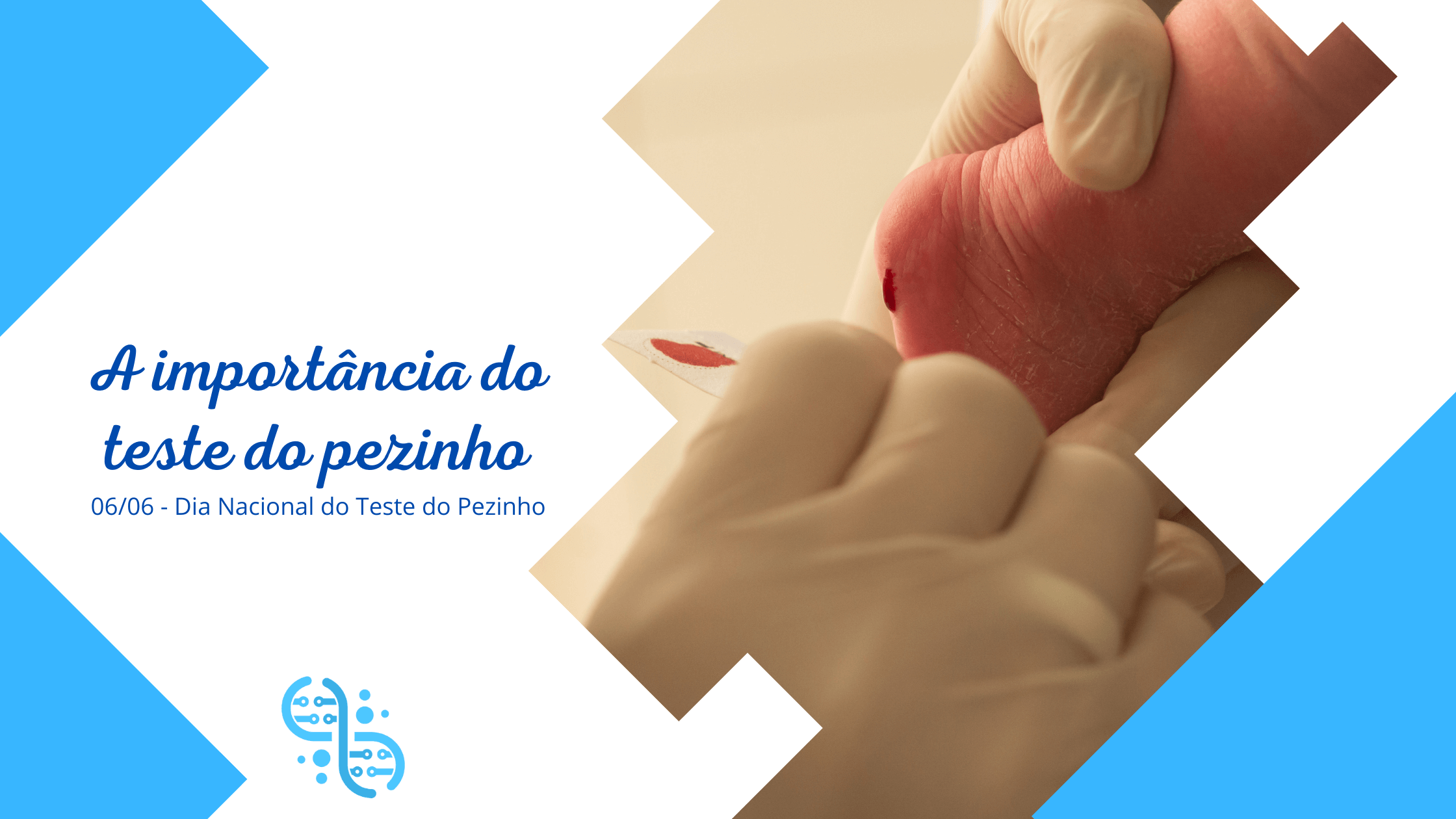 este do pezinho - 06 de Junho, Dia Nacional do Teste do Pezinho